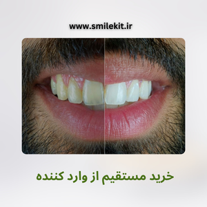 خمیر دندان سفیدکننده گلوری اسمایل ۲۰۲۵